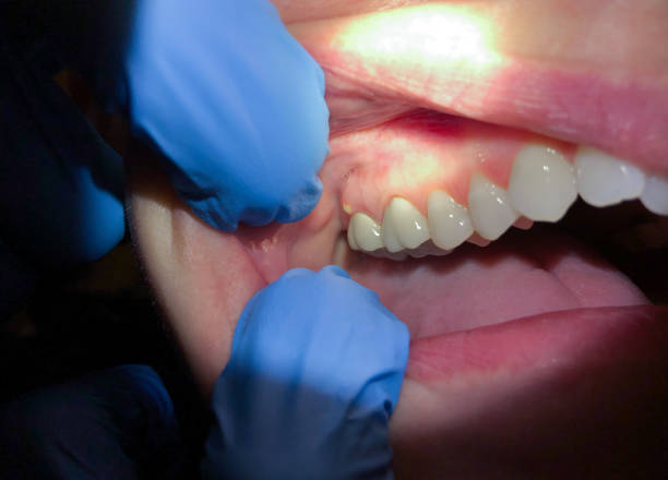 Best Emergency Cosmetic Dentistry in Pisgah, AL
