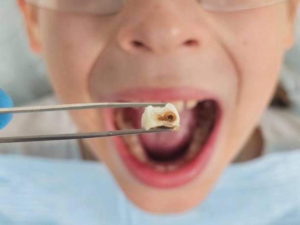 Best Pediatric Emergency Dentist in Pisgah, AL
